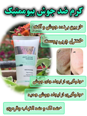 کرم ژل آنتی اکنه برای لک وکک مک و جای جوش چند کاره برند گاتیو40میل